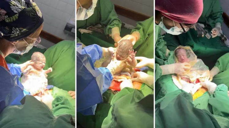 NACIERON EN SALTA TRIGEMELAS IDÉNTICAS: UN CASO QUE OCURRE UNA VEZ CADA MILLÓN DE&nbsp;PARTOS